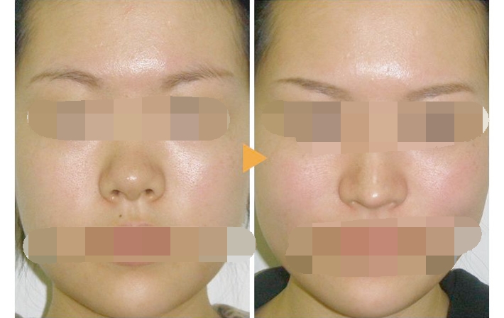 ���ͺ��ؼ��w¡��Ч����ô��