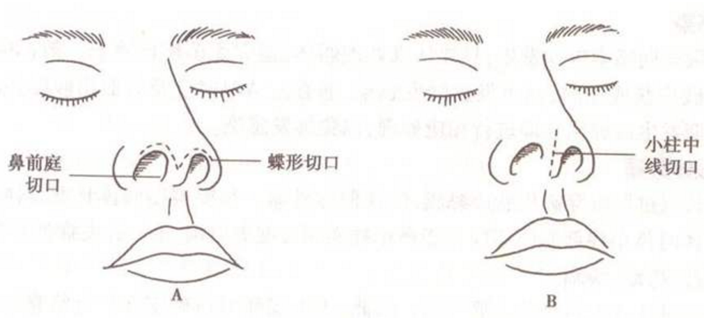 ���ͺ���¡��