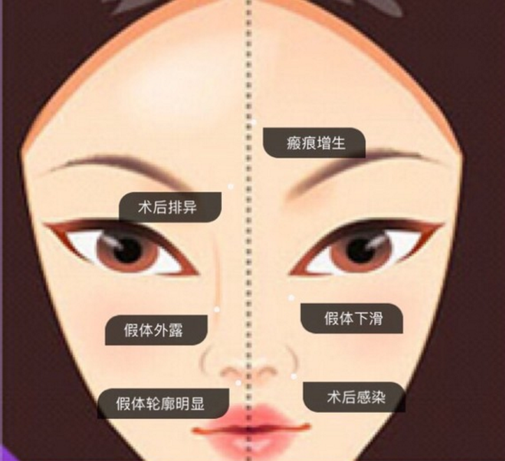 ���ͺ�������¡��