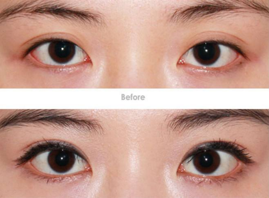 ���ͺ����_�۽�