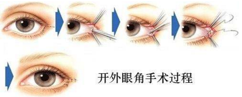 ���ͺ����_(k��i)�۽�