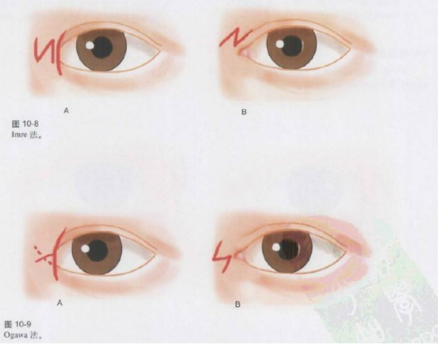 ΢�ňDƬ_20190625120726