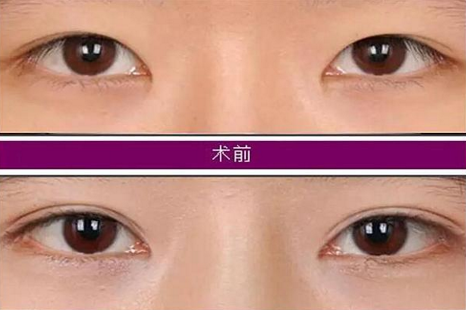 ΢�ňDƬ_20190627103106