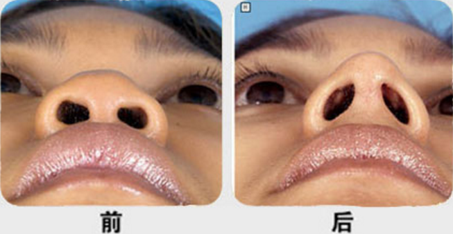 ���ͺ��رǲ�����