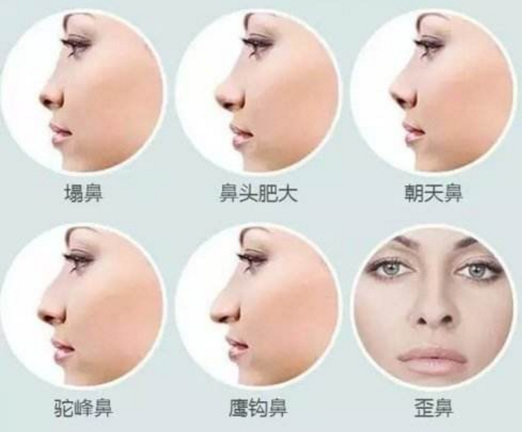 ���ͺ���¡��