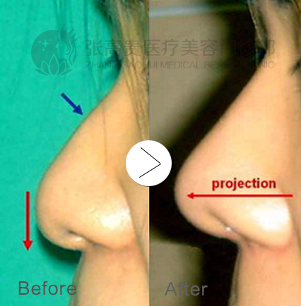 ���ͺ�������¡��