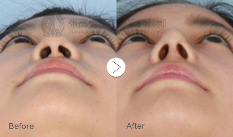 ���ͺ���������¡�����g��ʲô����