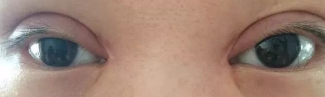 ���ͺ����p��Ƥ