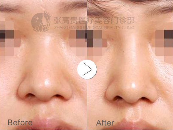 ���ͺ��؏����F¡��