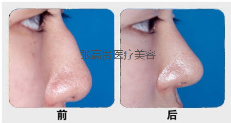 ����¡������