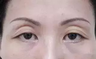 �����p��Ƥ�t(y��)Ժ