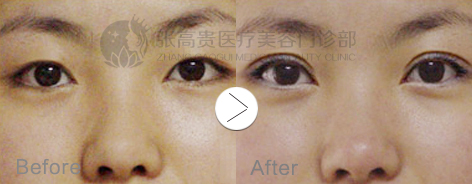 ���ͺ����p��Ƥ