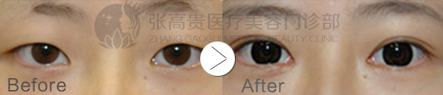 ���ͺ��������p��Ƥ