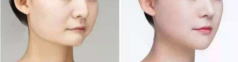 ���ͺ���¡��