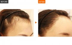 ���ͺ������ΰl(f��)�H��Ҫע����Щ��