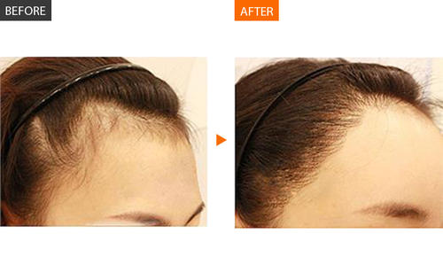 u=2157739565,2409895485&fm=26&gp=0