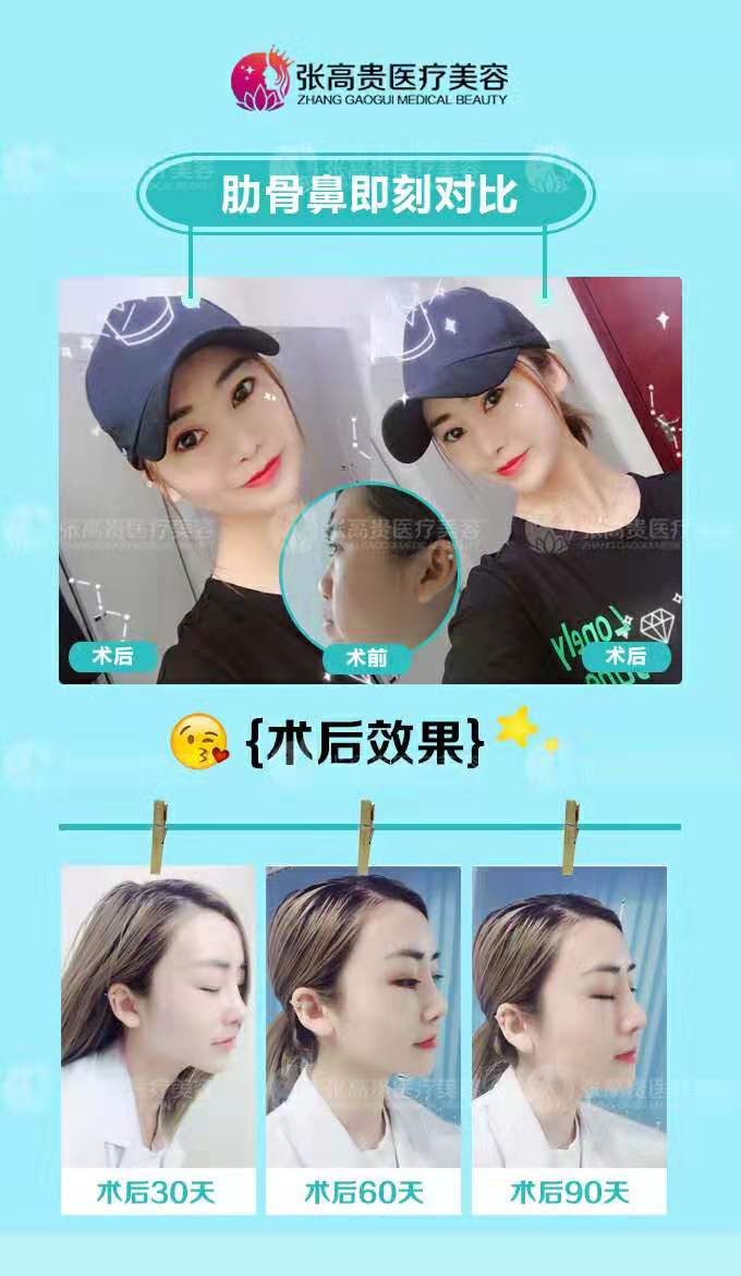 ��������¡�� style=