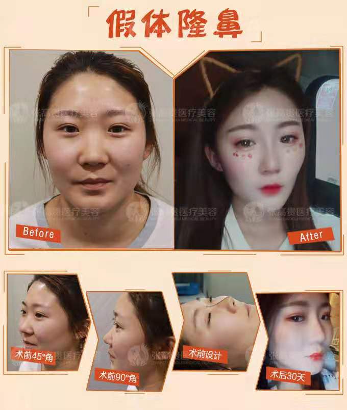 ����¡���ļҺ�