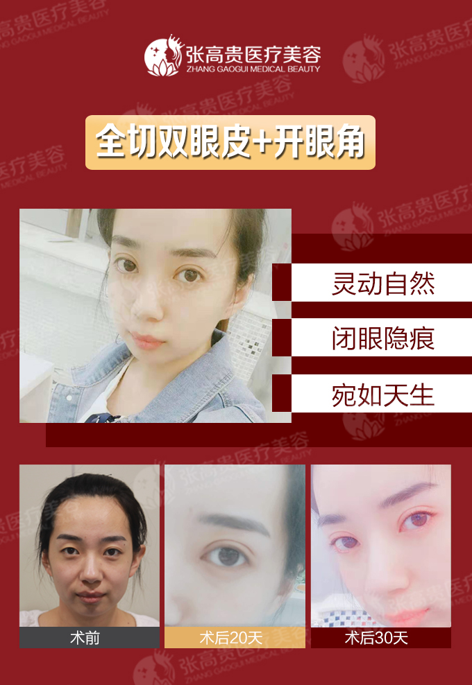 ���ͺ����p��Ƥ