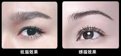 �������μyü