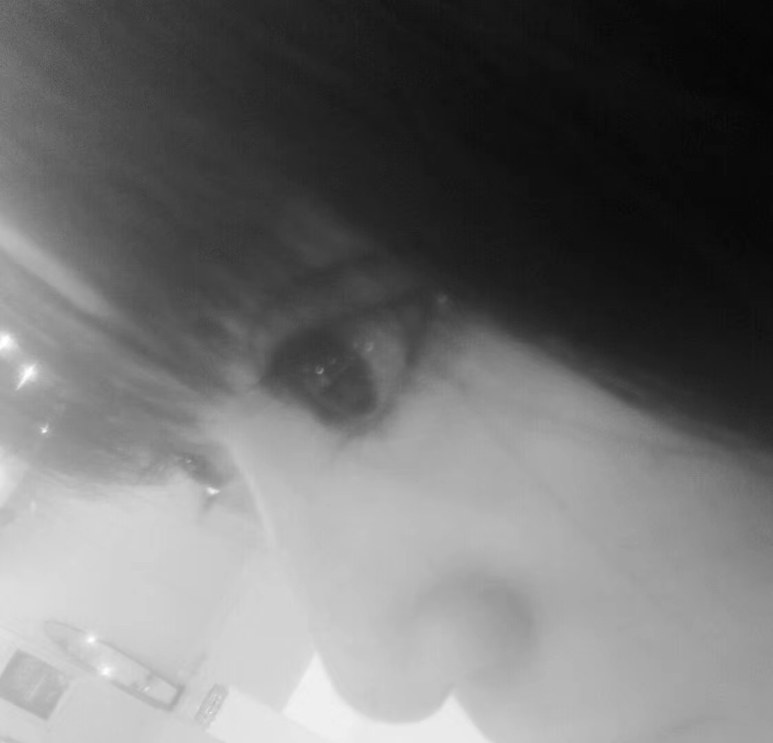 ���ͺ����p��Ƥ�����t(y��)Ժ