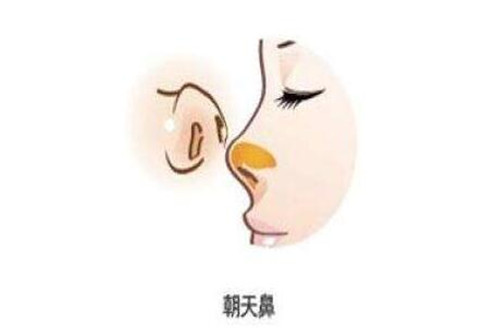 ���ͺ���¡��