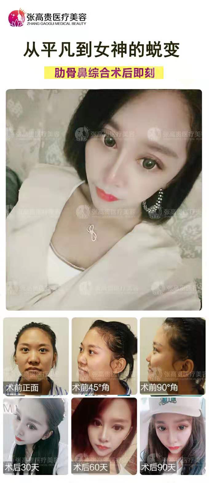 ���ͺ���¡��