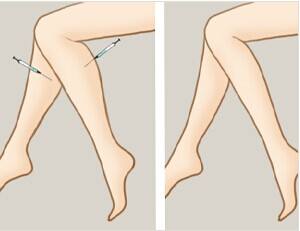 ���ͺ��������t(y��)Ժ