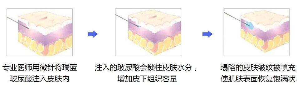 ���ͺ�������