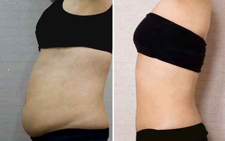 ���ͺ�������