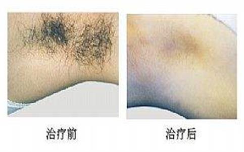 ���ͺ�������