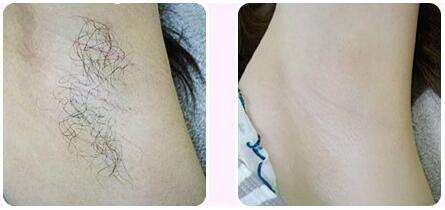 ���ͺ�������