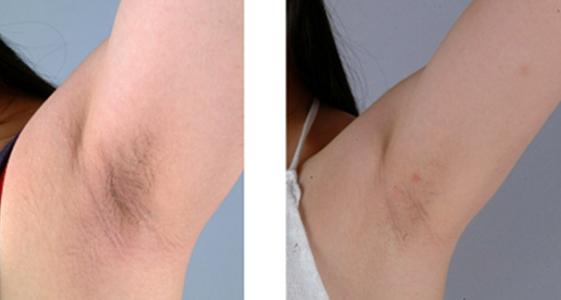 ���ͺ�������