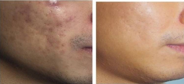 ���ͺ�������