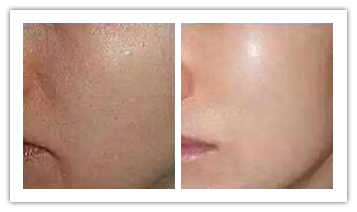 ���ͺ�������