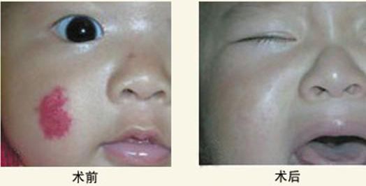 ���ͺ�������