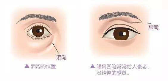 ���ͺ�������