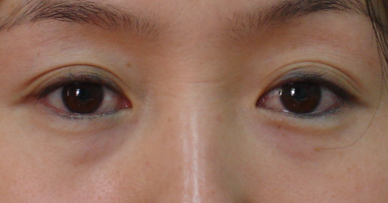 ���ͺ�������