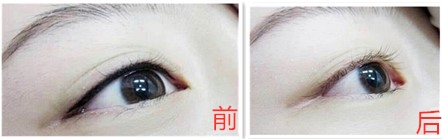 ���ͺ�������