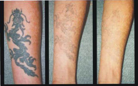 ���ͺ�������