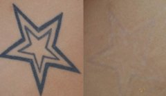 ����ϴ�y����p��Ƥ�w�᣿