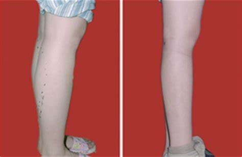 ���ͺ�������