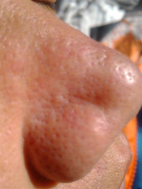 ���ͺ�������