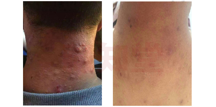 ���ͺ�������