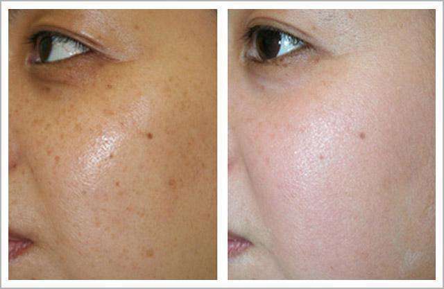 ���ͺ�������