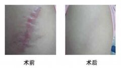 ����ȥ�̺ە�(hu��)����(hu��)ʹ����