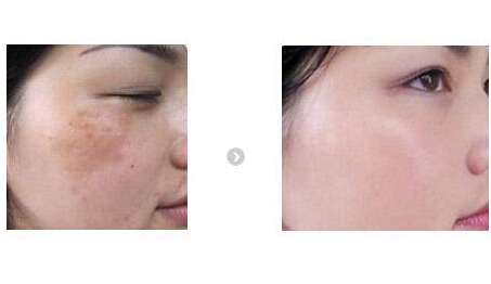 ���ͺ�������