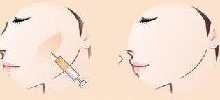 ���ͺ�������