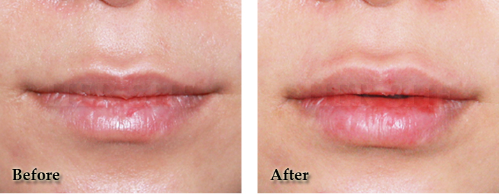 ���ͺ�������