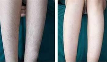 ���ͺ�������